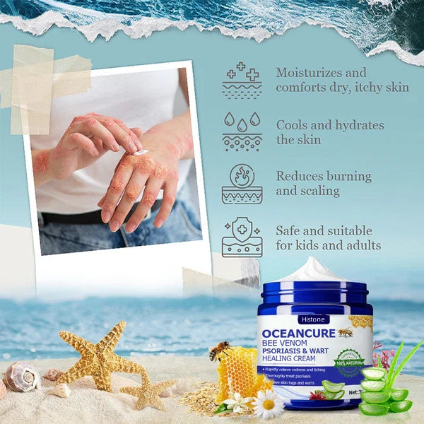 šHistone⢠OceanCure Bee Venom Psoriasis & Wart Healing Cream